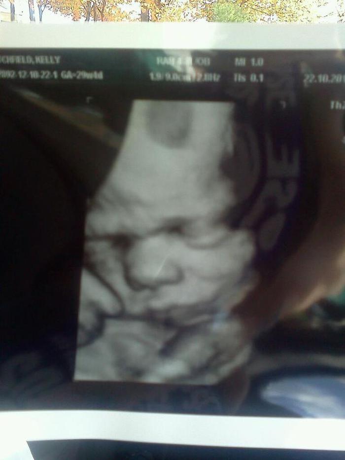 29weeks. 3D ultrasound of my son
