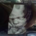 29weeks. 3D ultrasound of my son