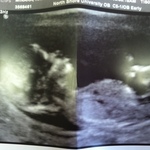 Our baby, wk 12.5