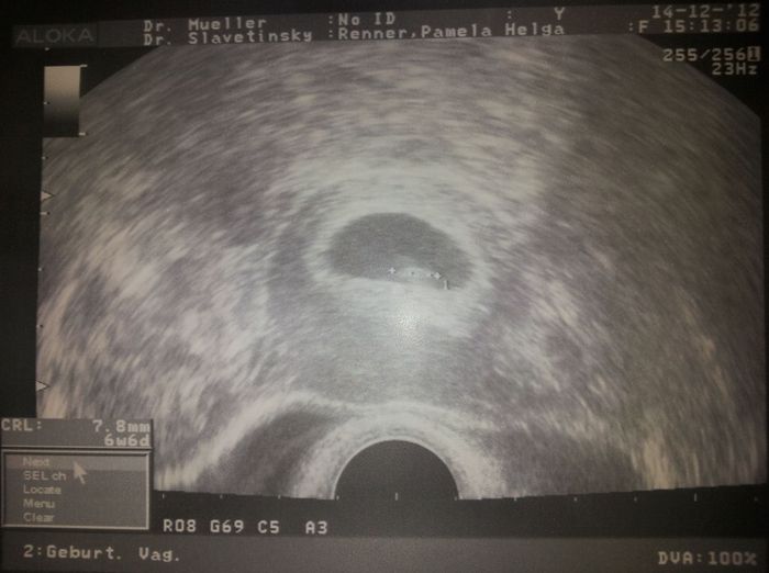 first pic... positive heartbeat <3