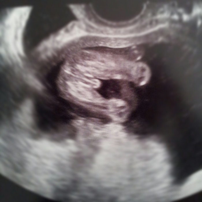 16 weeks into my pregnancy, he let us know he was a boy lol