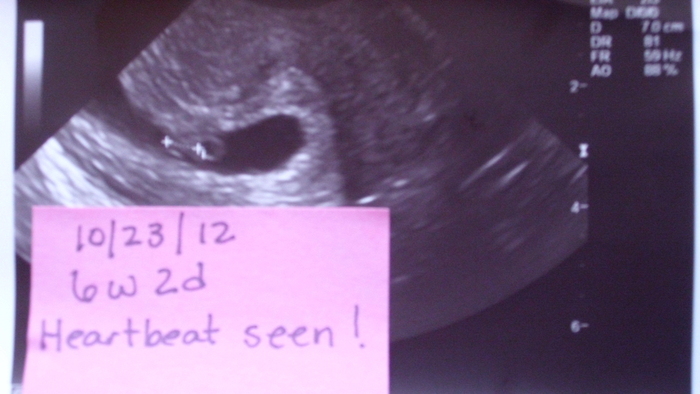 6 weeks
Heartbeat!!