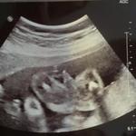 It's a Boy!!