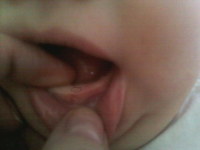 First tooth!