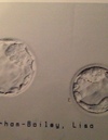 2 stage 4 blastocyst !! implanted 