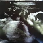Luke, wk 23 - a little smooshed in the pic, but he's healthy & waving!