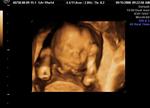 Our sweet baby girl...just over 19 weeks