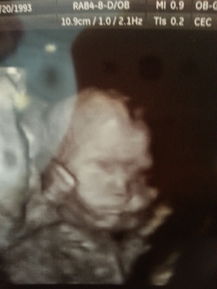 baby elsa at 21 weeks. Looks a lot like her daddy. <3