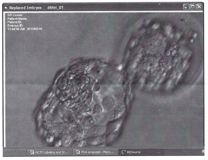 "embryo #2"