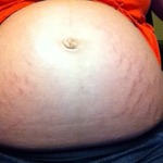 My belly is full of stretchmarks.