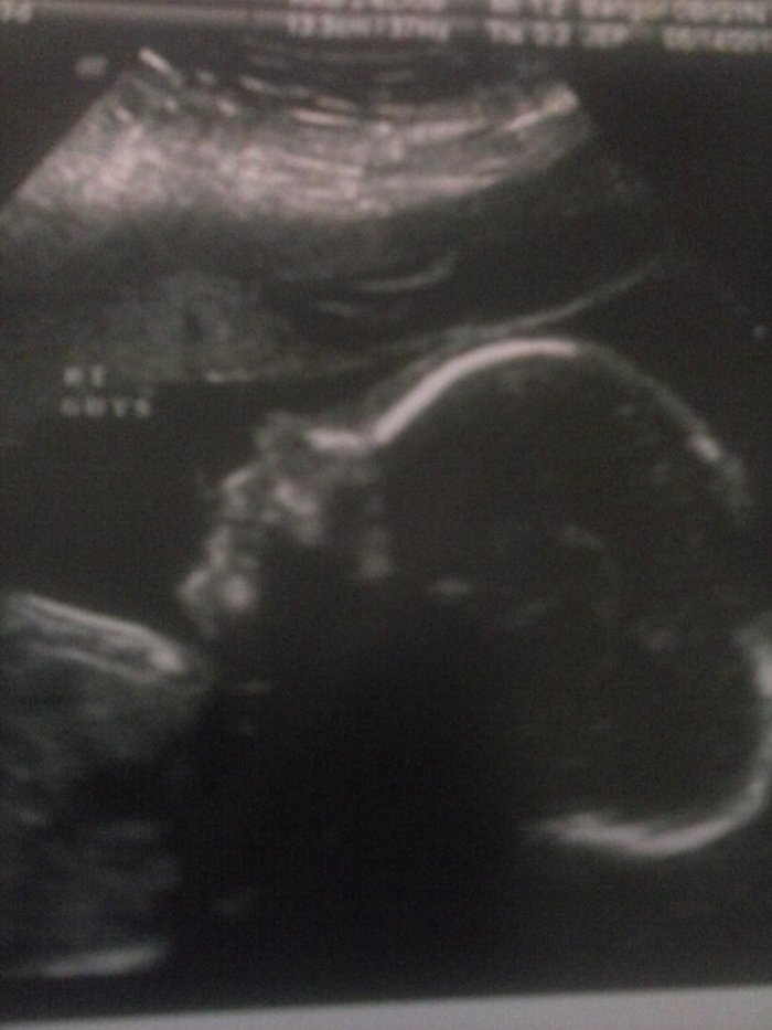 First pic of Colton...May 14, 2013