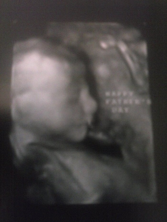 Ultrasound 2. June 11, 2013. Happy father's day Josh!