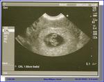 1st ultrasound 10-23-08