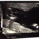 its a BOY! 17 weeks :)