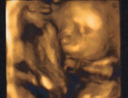 22.5 weeks 4D scan - baby blue's face