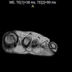 Foot MRI looks little like a brain MRI