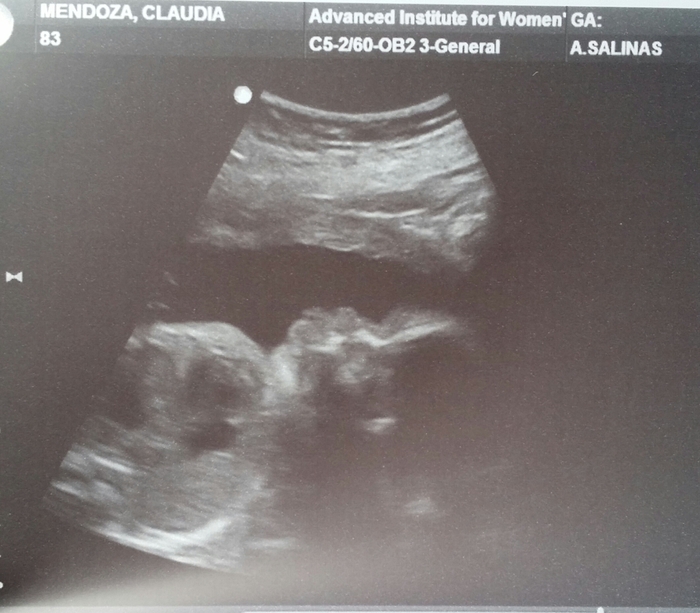 @ 28 wks weighing approximately 2 lbs 14 oz ♡