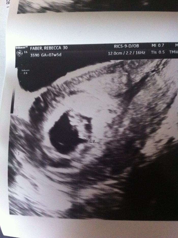 Baby measuring 8 weeks 2 days on May 21, 2014 =)