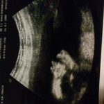 20weeks profile (i call it the demon picture) lol!!