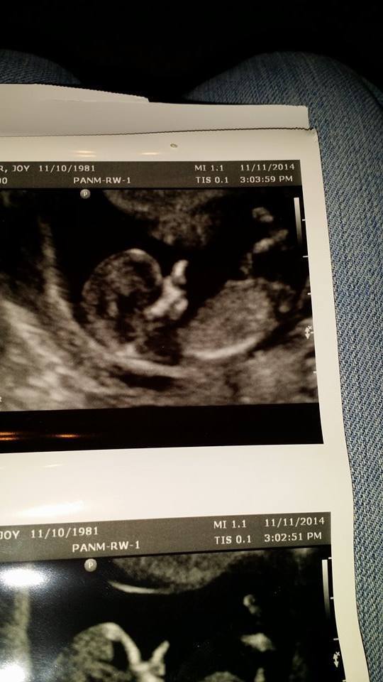 Newest Member of the Knight Family! Due 5/25/15