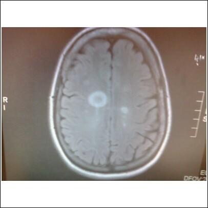 BRAIN MRI JUNE 15 2009