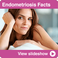Endometriosis: Get the Facts