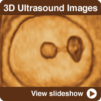 A Baby's Story: 3D Ultrasounds of Every Week