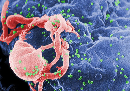 MYTH: HIV Means You Have AIDS