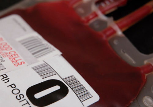 MYTH: HIV Is Commonly Spread Through Blood Transfusions