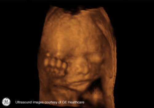 Week 20: Pregnancy Week By Week 3D Ultrasound Images