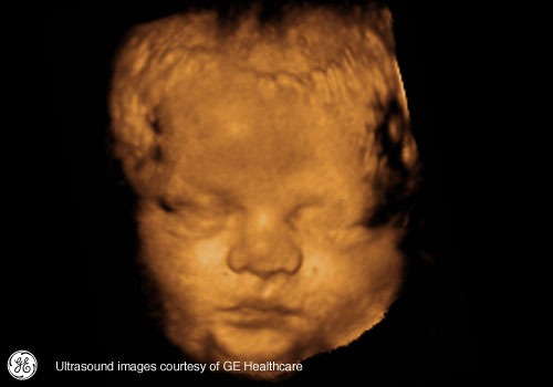 Week 39: Pregnancy Week By Week 3D Ultrasound Images