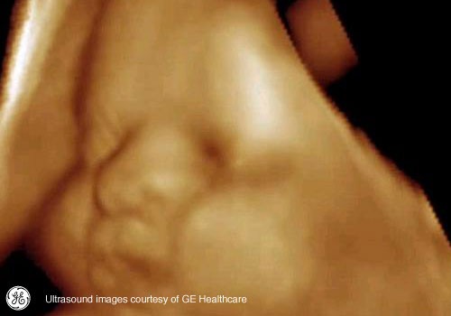 Week 40: Pregnancy Week By Week 3D Ultrasound Images