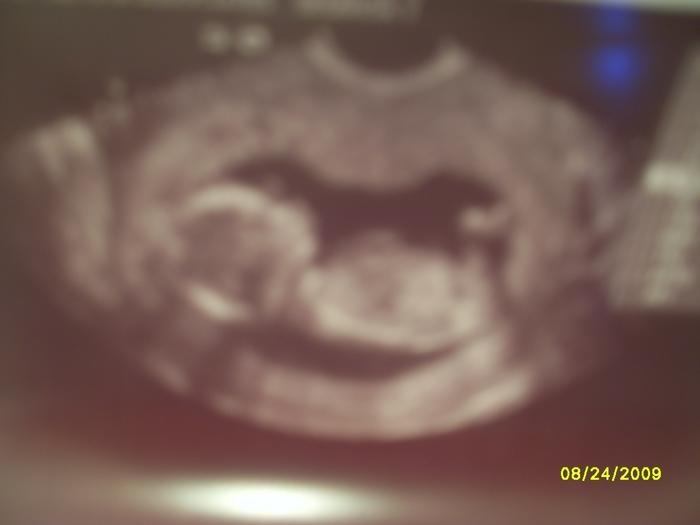 baby boy at 14 weeks. Internal ultrasound