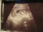 our baby at 12 weeks