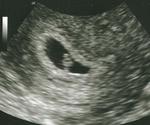 7 week ultrasound...so tiny!