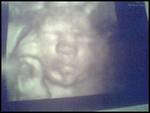 3D4D U/S pic 27w3d he weighs about 2 1/2lbs