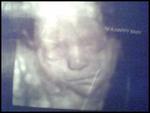 3D4D U/S pic 27w3d he weighs about 2 1/2lbs