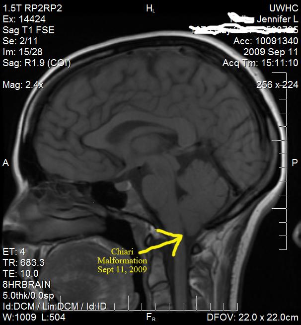 Sept 09 MRI