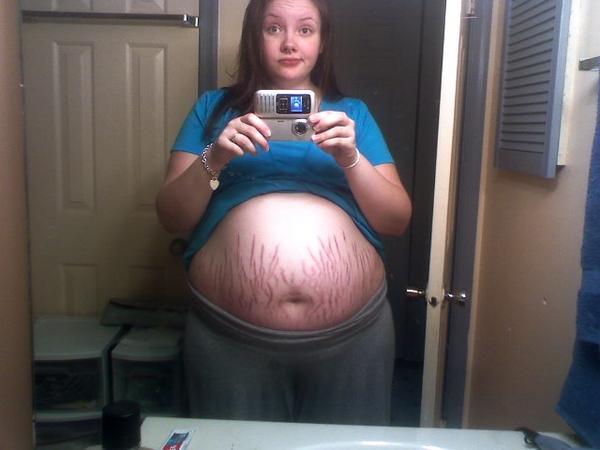 34 weeks, 5 days and covered with stretch marks