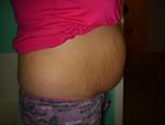 bump at 7 weeks 