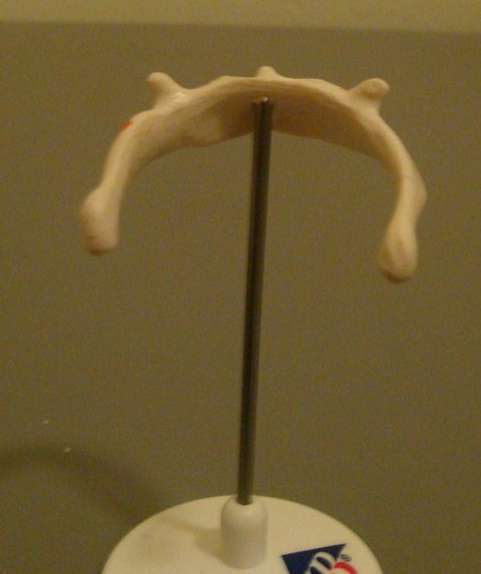 normal hyoid bone anatomy model