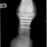 4 weeks post op.  4 screws put his leg back together