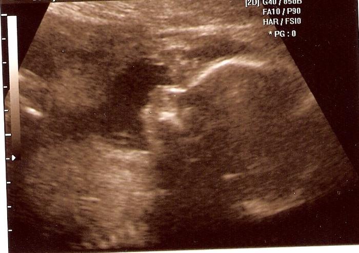 Our baby girl 12-22-09    22w 4d