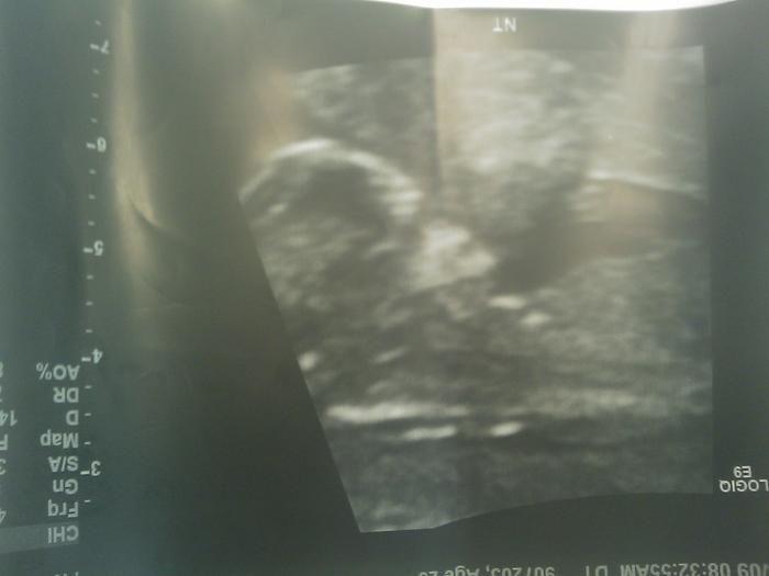 My baby. Can you see where he is, or what your looking at, lol?