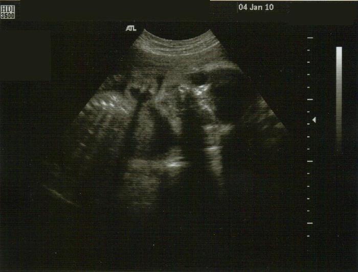 28 weeks profile/face view
