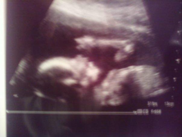 It's a girl :)