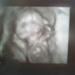 Braeden David 18 weeks: our little alien baby :-)