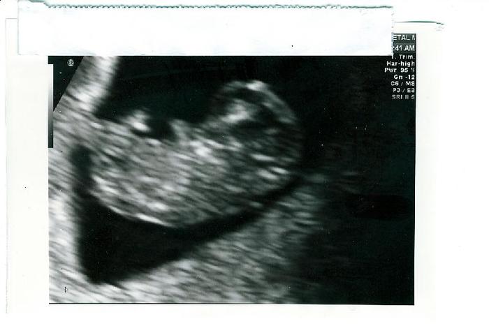 1st ultrasound