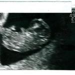 1st ultrasound