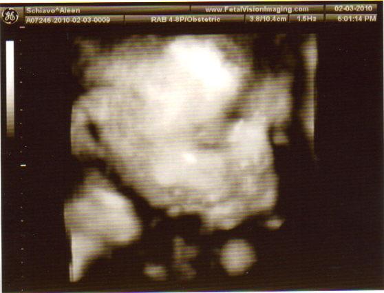 29 Weeks~ Look at my baby's cheeks :)
